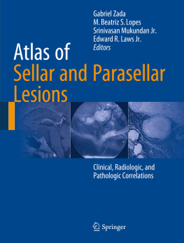 Laws Jr Edward R. - Atlas of Sellar and Parasellar Lesions Clinical, Radiologic, and Pathologic Correlations