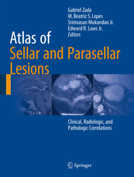 Laws Jr Edward R. Atlas of Sellar and Parasellar Lesions Clinical, Radiologic, and Pathologic Correlations