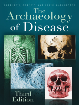 Manchester Keith - The Archaeology of Disease