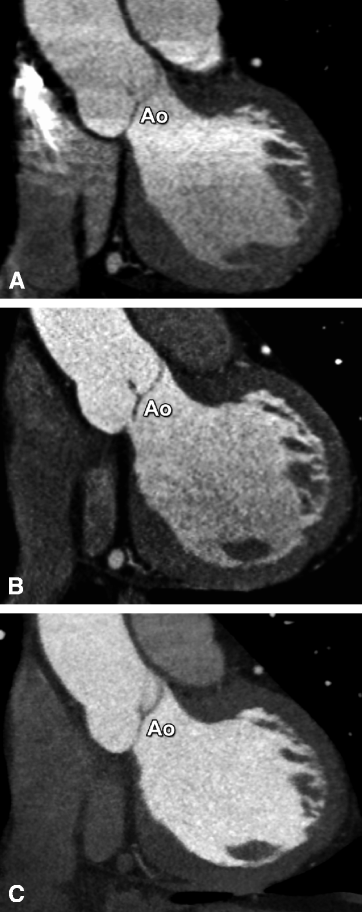 Fig 22 The improved depiction of the arterial phase using 64-row CT Panel B - photo 2