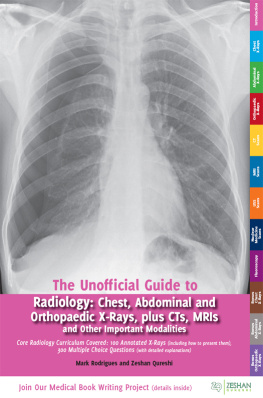 Mark Rodrigues - The Unofficial Guide to Radiology: Chest, Abdominal, Orthopaedic X Rays, plus CTs, MRIs and Other Important Modalities