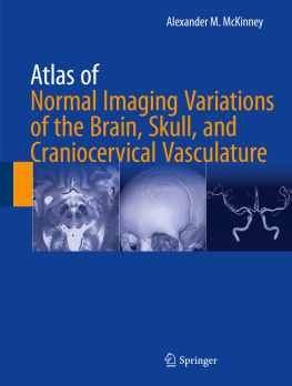 Mckinney - Atlas of Normal Imaging Variations of the Brain, Skull, and Craniocervical Vasculature