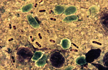 Fig 12 Light micrograph of the gram-negative plague bacteria Yersinia - photo 2