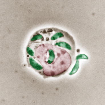 Fig 14 Light micrograph of a host cell containing tachyzoites of Toxoplasma - photo 4