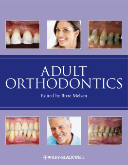 Melsen - Adult Orthodontics