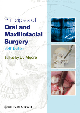 Moore Principles of Oral and Maxillofacial Surgery