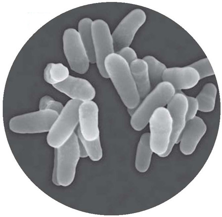 A scanning electron micrograph image of Mycobacterium tuberculosis M - photo 4