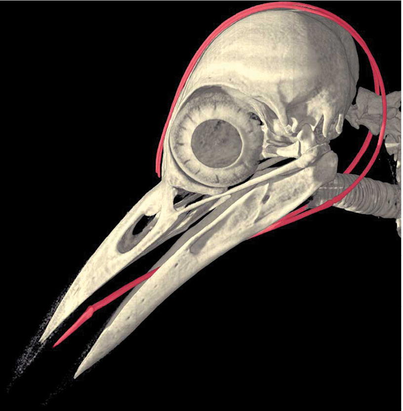 FIGURE 3 Retracted Hyoid Position This high-resolution X-ray computed - photo 8