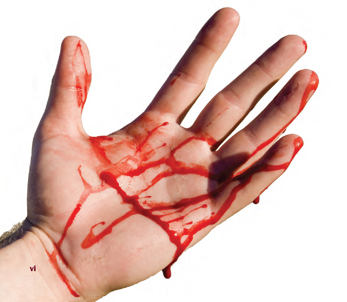 The sight of blood from a wound causes many people to feel faint Blood is - photo 1