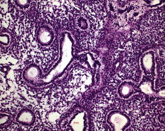 Fig 11 Lung specimen in the early developmental tubular stage eight week of - photo 1