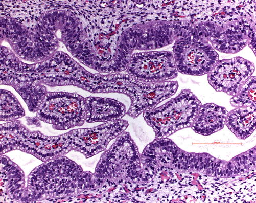 Fig 14 Lung specimen at the development age of 18th gestation week the - photo 4