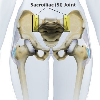 Contents Sacroiliac Joint Pain Causes Posterior Pelvic Pain Sacroiliac Joint - photo 2