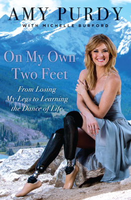 Purdy On my own two feet: from losing my legs to learning the dance of life