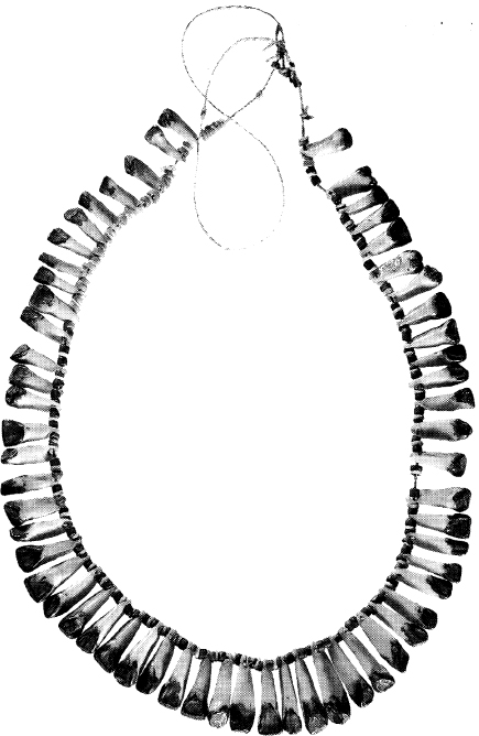 Necklace of 59 human teeth brought back by Jack Renton A detailed description - photo 1