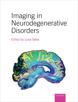 Saba Imaging in Neurodegenerative Disorders