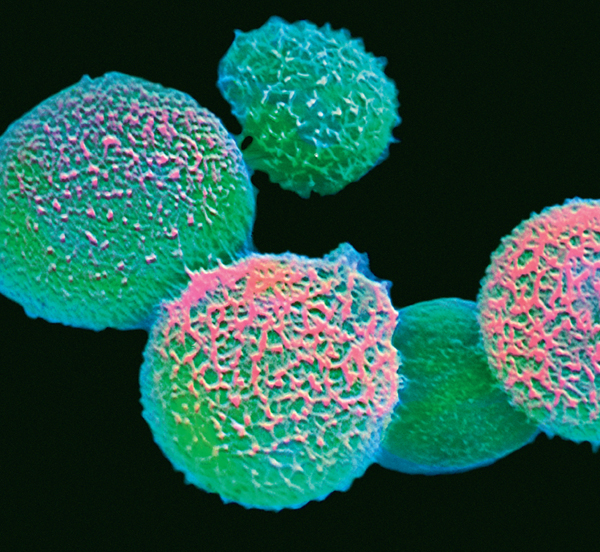 Cryptococcus fungi scanning electron micrograph This false-colour image - photo 1