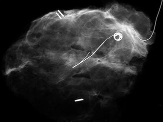 Fig 12 Specimen x-ray with attached wire and orientating clips The role of - photo 2