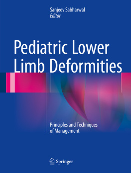 Sanjeev Sabharwal - Pediatric Lower Limb Deformities