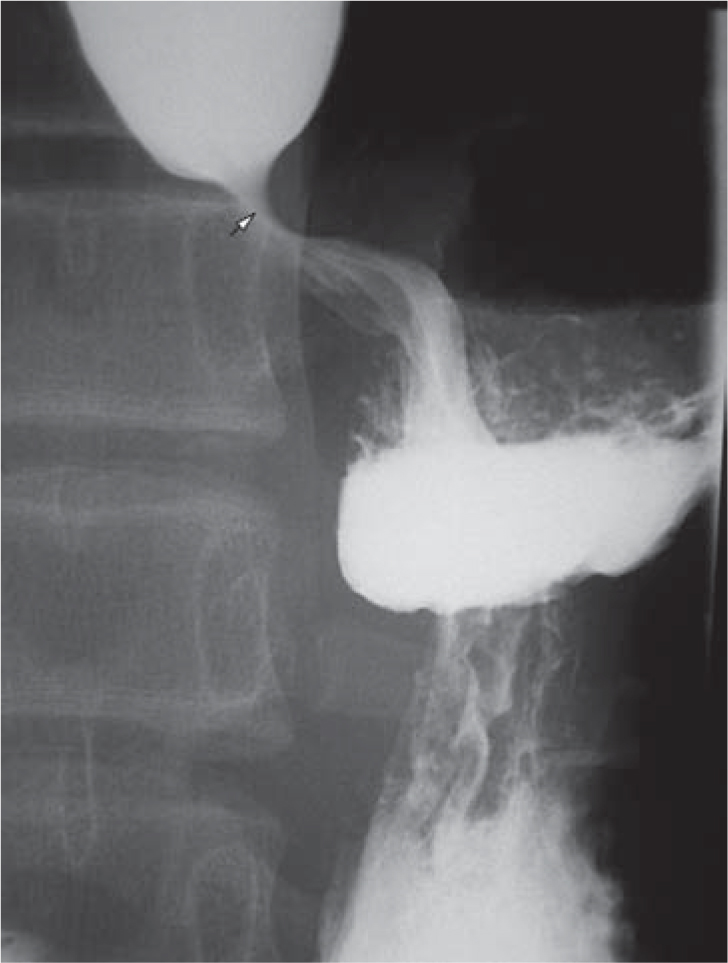 ABC of Pediatric Surgical Imaging - image 10