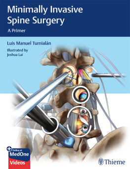 Luis M. Tumialan - Minimally Invasive Spine Surgery: A Primer