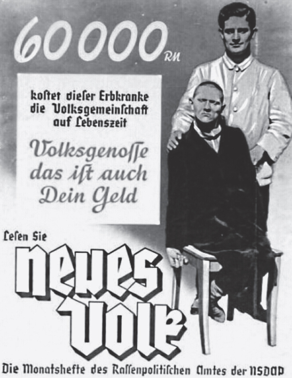 Nazi eugenics propaganda poster Text reads This person suffering from - photo 5