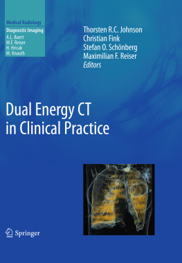 Thorsten Johnson Christian Fink Stefan O. Schönberg Dual Energy CT in Clinical Practice