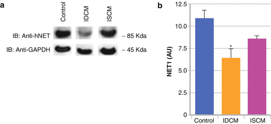 Figure 1-3 Down-regulation of the presynaptic hNET1 in heart failure In - photo 3