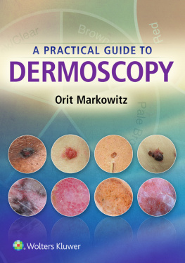 Ovid Technologies Inc A Practical Guide to Dermoscopy, 1e