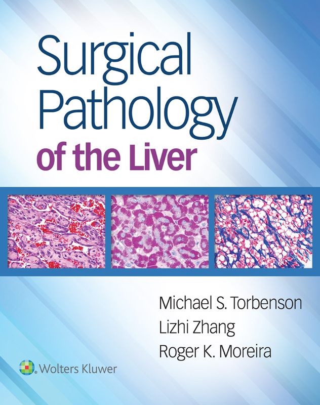 Surgical Pathology of the Liver Michael S Torbenson MD Professor of - photo 1