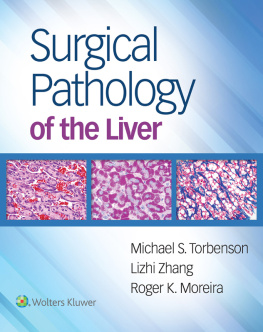 Michael S. Torbenson MD Surgical Pathology of the Liver