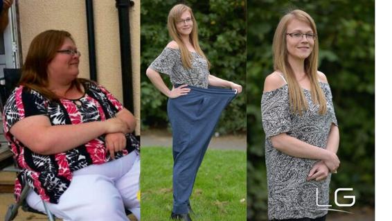 MICHELLE I was over 21 stone and I lost 12 stone in weight in under 2 years - photo 21