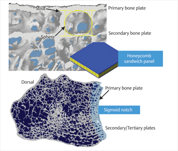 Fig 11 Anatomy of the subchondral bone plate of the distal radius Copyright - photo 1