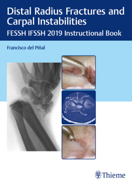 Pinal Francisco del - Distal Radius Fractures and Carpal Instabilities: FESSH IFSSH 2019 Instructional Book