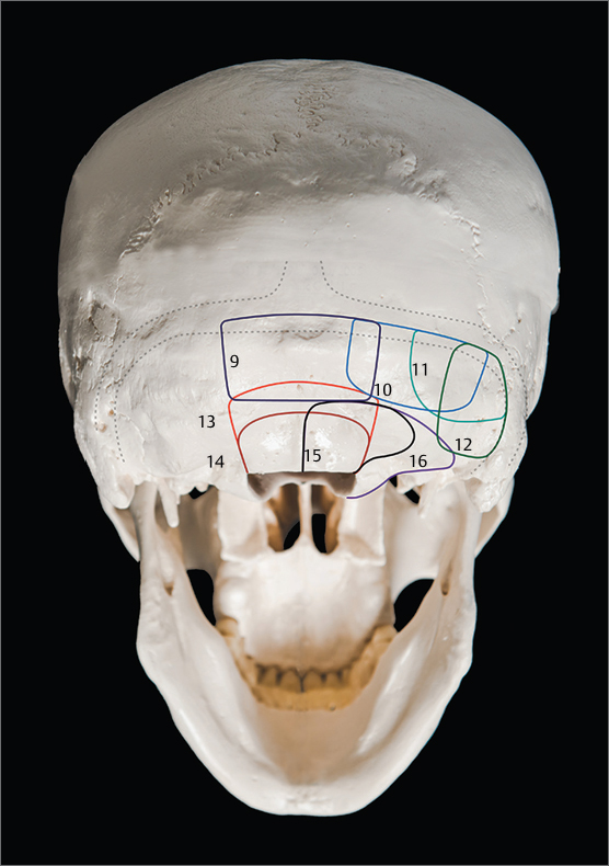 Fig 12 Systematics of skull base craniotomiesinfratentorial Craniotomies of - photo 2