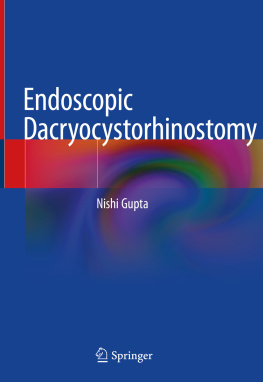 Nishi Gupta Endoscopic Dacryocystorhinostomy