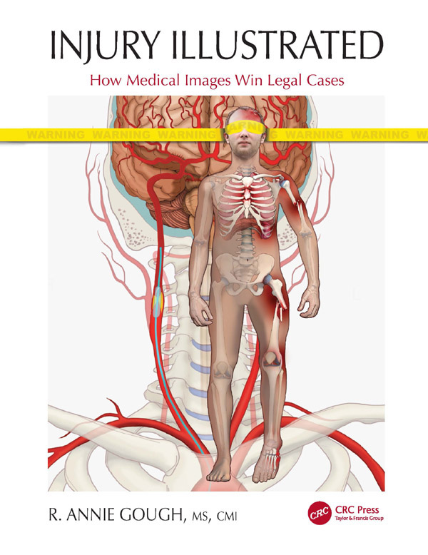 Injury Illustrated Injury Illustrated How Medical Images Win Legal Cases - photo 1