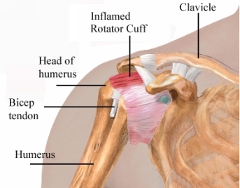 What caused the pain T he doctor explained that my pain was caused by - photo 2