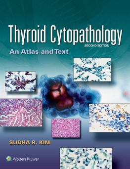 Sudha R. Kini - Thyroid Cytopathology