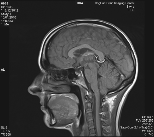 An MRI scan of the authors brain Courtesy of the University of Kansas - photo 3