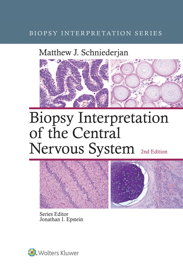 BIOPSY INTERPRETATION SERIES BIOPSY INTERPRETATION OF THE CENTRAL NERVOUS - photo 1