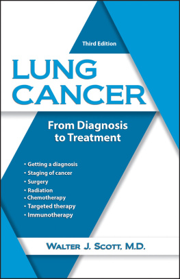 Walter Scott Lung Cancer