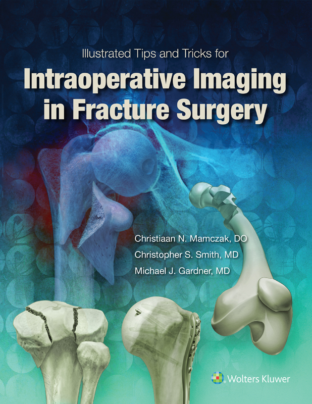 Illustrated Tips and Tricks for Intraoperative Imaging in Fracture Surgery - photo 1