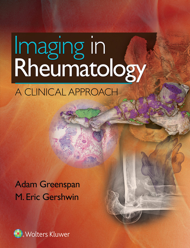 Imaging in Rheumatology A Clinical Approach FIRST EDITION Adam Greenspan MD - photo 1