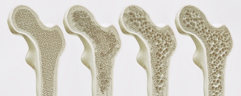 Skeletal Systems There are two types of skeletons The Axial and The - photo 2