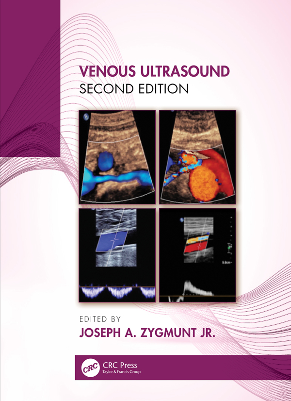 Venous Ultrasound Second Edition Venous Ultrasound Second Edition Edited by - photo 1