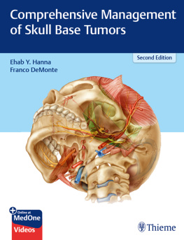 Ehab Y. Hanna - Comprehensive Management of Skull Base Tumors