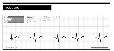 My heart EKG at age 35 but as I stared at the paper all I could see was the - photo 4