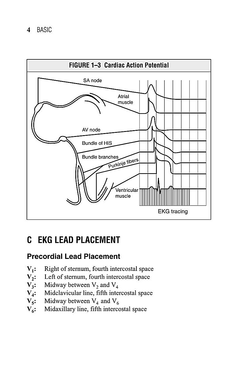 Interpreting EKG EKG Interpretation For Nurses EKG Interpretation Practice EKG Interpretation Book - photo 8