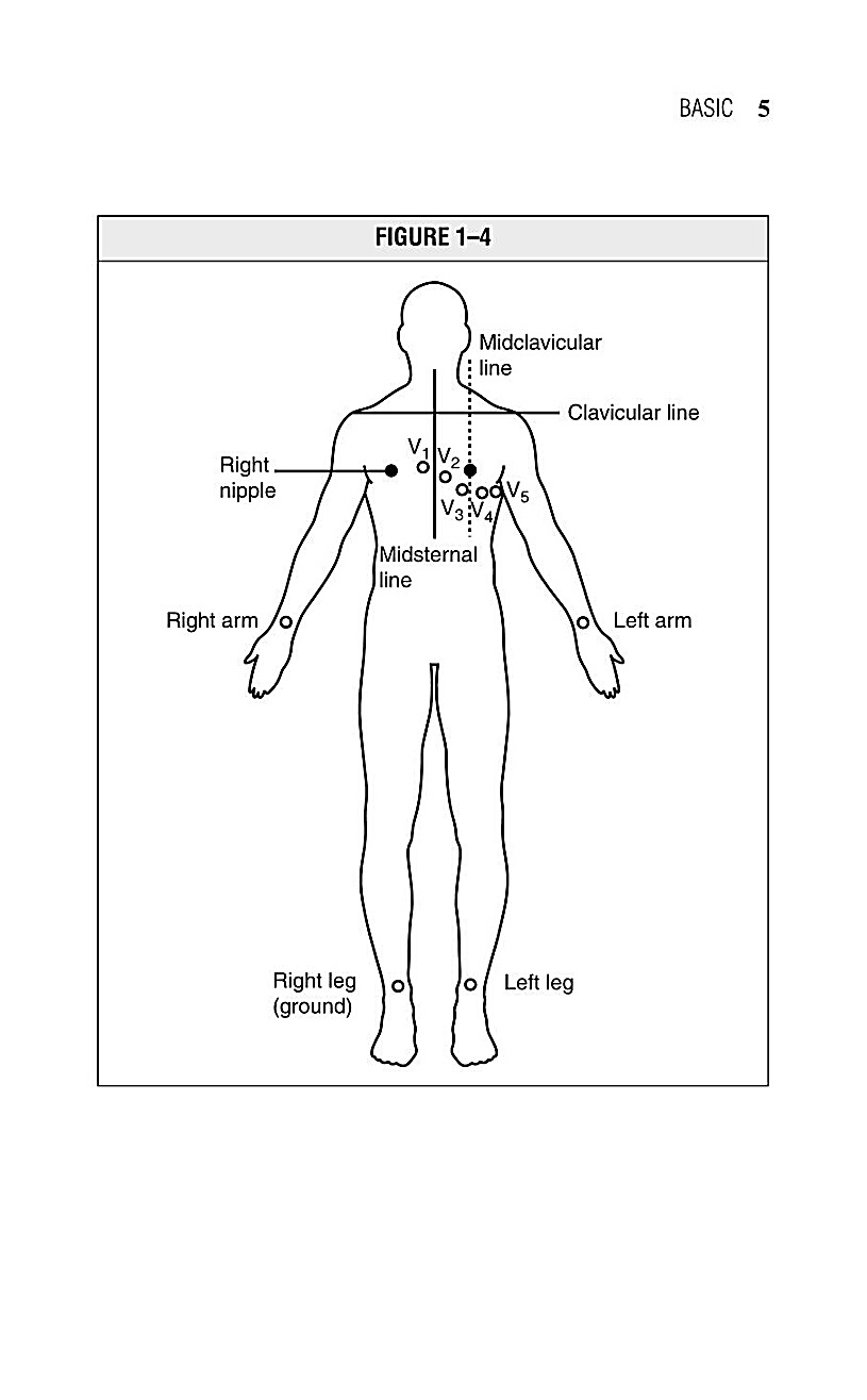 Interpreting EKG EKG Interpretation For Nurses EKG Interpretation Practice EKG Interpretation Book - photo 9