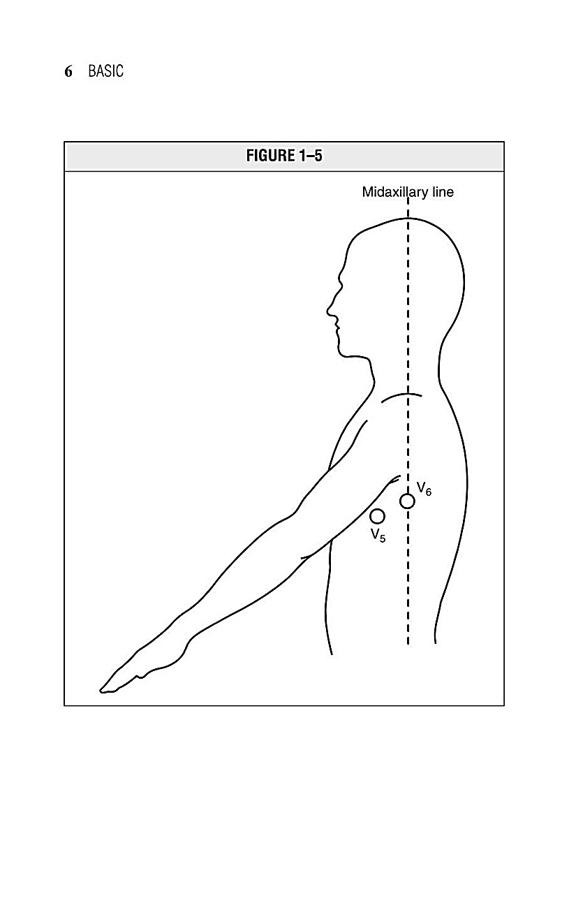 Interpreting EKG EKG Interpretation For Nurses EKG Interpretation Practice EKG Interpretation Book - photo 10